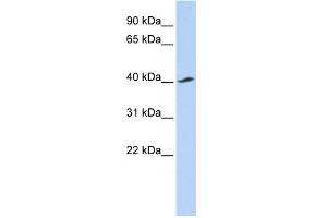 WB Suggested Anti-KCNJ16 Antibody Titration:  0. (KIR5.1 Antikörper  (Middle Region))