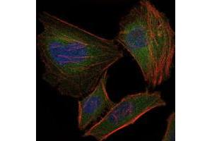 Immunofluorescence analysis of HeLa cells using TNNI2 monoclonal antobody, clone 2F12G2  (green). (TNNI2 Antikörper)