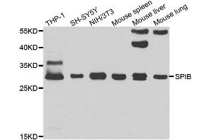 Western blot analysis of extracts of various cell lines, using SPIB antibody. (SPIB Antikörper)