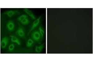 Immunofluorescence analysis of HeLa cells, using CDH23 Antibody. (CDH23 Antikörper  (AA 61-110))