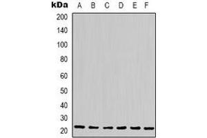 Western blot analysis of Cyclophilin B expression in Hela (A), Jurkat (B), 293T (C), HepG2 (D), NIH3T3 (E), rat liver (F) whole cell lysates. (PPIB Antikörper)