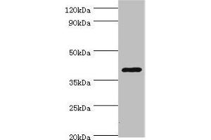 Western blot All lanes: HDAC11 antibody at 2 μg/mL + Mouse brain tissue Secondary Goat polyclonal to rabbit IgG at 1/10000 dilution Predicted band size: 40, 34 kDa Observed band size: 40 kDa (HDAC11 Antikörper  (AA 1-347))