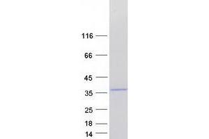 Western Blotting (WB) image for HAUS Augmin-Like Complex, Subunit 1 (HAUS1) (Transcript Variant 1) protein (Myc-DYKDDDDK Tag) (ABIN2722442)