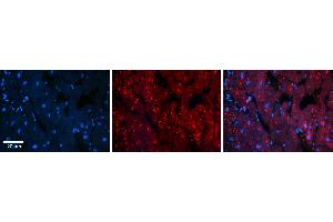 Rabbit Anti-INSR Antibody   Formalin Fixed Paraffin Embedded Tissue: Human Heart Tissue Observed Staining: Cytoplasm in cardiomyocytes Primary Antibody Concentration: 1:100 Other Working Concentrations: 1:600 Secondary Antibody: Donkey anti-Rabbit-Cy3 Secondary Antibody Concentration: 1:200 Magnification: 20X Exposure Time: 0. (Insulin Receptor Antikörper  (Middle Region))