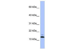 ASAH1 antibody used at 1 ug/ml to detect target protein. (ASAH1 Antikörper)