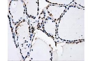 Immunohistochemical staining of paraffin-embedded Kidney tissue using anti-PKMYT1mouse monoclonal antibody. (PKMYT1 Antikörper)