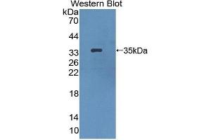 Detection of Recombinant HPS1, Mouse using Polyclonal Antibody to Hermansky Pudlak Syndrome Protein 1 (HPS1)