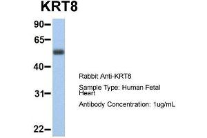Host:  Rabbit  Target Name:  KRT8  Sample Type:  Human Fetal Heart  Antibody Dilution:  1. (KRT8 Antikörper  (Middle Region))