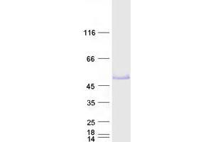 Western Blotting (WB) image for Forkhead Box P3 (FOXP3) (Transcript Variant 1) protein (Myc-DYKDDDDK Tag) (ABIN2721384)