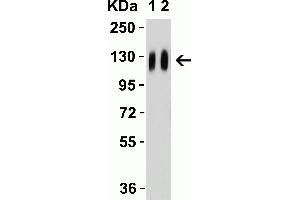 Western Blot Validation with SARS-CoV-2 (COVID-19) Spike Recombinant Protein Loading: 50 ng per lane of SARS-CoV-2 (COVID-19) Spike S1 recombinant protein (97-087. (SARS-CoV-2 Spike Antikörper)