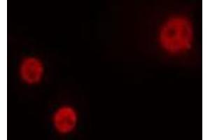 ABIN6274264 staining HeLa cells by IF/ICC. (HOXA1 Antikörper  (Internal Region))