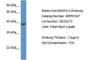Western Blotting (WB) image for anti-RAD51 Homolog D (RAD51D) (C-Term) antibody (ABIN2788836) (RAD51D Antikörper  (C-Term))