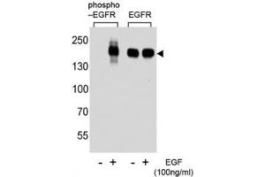 Western blot analysis of extracts from A431 cell, untreated or treated with EGF, using phospho-EGFR antibody (left) or nonphos Ab (right).