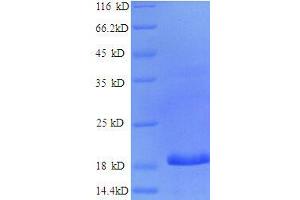 SDS-PAGE (SDS) image for CCAAT/enhancer Binding Protein (C/EBP), gamma (CEBPG) (AA 1-148), (partial) protein (His tag) (ABIN1095537)