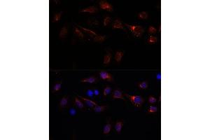 Immunofluorescence analysis of U-2 OS cells using PFDN4 antibody (ABIN7269508) at dilution of 1:100. (PFDN4 Antikörper  (AA 1-134))