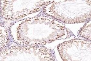 Immunohistochemistry analysis of paraffin-embedded mouse testis using,NUP133 (ABIN7074909) at dilution of 1: 4800 (NUP133 Antikörper)