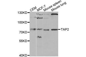 TAP2 Antikörper  (AA 430-680)