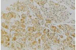 ABIN6276762 at 1/100 staining Human gastric tissue by IHC-P.