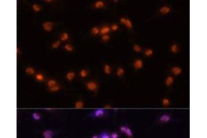 Immunofluorescence analysis of U-251MG cells using PRPF8 Polyclonal Antibody at dilution of 1:100 (20x lens). (PRPF8 Antikörper)