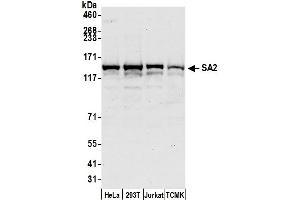 Western Blotting (WB) image for anti-Stromal Antigen 2 (STAG2) (AA 1100-1150) antibody (ABIN7449357)
