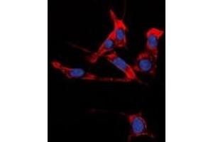 Immunofluorescent analysis of EPHB1/2 staining in HuvEc cells. (EPHB1/2 Antikörper)