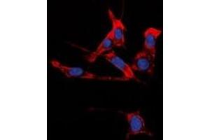Immunofluorescent analysis of EPHB1/2 staining in HuvEc cells. (EPHB1/2 Antikörper)