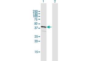 Western Blot analysis of FLJ22167 expression in transfected 293T cell line by FLJ22167 MaxPab polyclonal antibody. (FLJ22167 (AA 1-316) Antikörper)