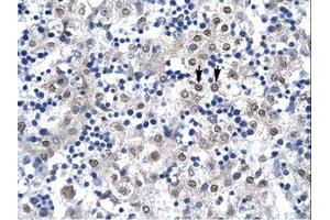 Image no. 2 for anti-Caudal Type Homeobox 4 (CDX4) (C-Term) antibody (ABIN6736267) (CDX4 Antikörper  (C-Term))