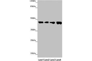 Western blot All lanes: FBXO22 antibody at 1. (FBXO22 Antikörper  (AA 104-403))