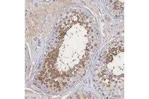 Immunohistochemical staining of human testis with C11orf58 polyclonal antibody  shows moderate cytoplasmic positivity in cells in seminiferus ducts at 1:20-1:50 dilution. (C11ORF58 Antikörper)