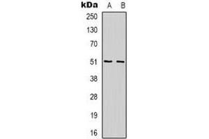 Western blot analysis of WIPF1 expression in Jurkat (A), K562 (B) whole cell lysates. (WIPF1 Antikörper  (C-Term))