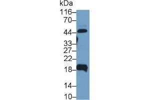 Detection of UPK2 in Human Urine using Polyclonal Antibody to Uroplakin 2 (UPK2) (Uroplakin 2 Antikörper  (AA 26-153))