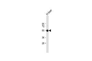 Anti-FADS2 Antibody at 1:2000 dilution + Human liver lysate Lysates/proteins at 20 μg per lane. (FADS2 Antikörper)