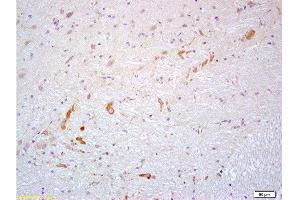 Formalin-fixed and paraffin embedded rat brain labeled with Anti- PROK2/Prokineticin 2 Polyclonal Antibody, Unconjugated  at 1:200 followed by conjugation to the secondary antibody and DAB staining (PROK2 Antikörper  (AA 28-100))