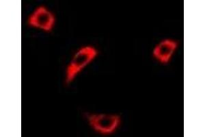 Immunofluorescent analysis of RASSF1 staining in Hela cells. (RASSF1 Antikörper)
