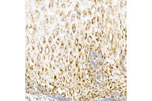 Immunohistochemistry of paraffin-embedded human esophagus using MDH2 Rabbit mAb (ABIN7268381) at dilution of 1:25 (40x lens). (MDH2 Antikörper)