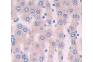 IHC-P analysis of Rat Tissue, with DAB staining. (Periostin Antikörper  (AA 24-173))