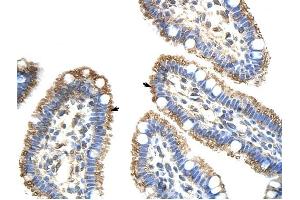 FZD9 antibody was used for immunohistochemistry at a concentration of 4-8 ug/ml to stain Epithelial cells of intestinal villus (arrows) in Human Intestine. (FZD9 Antikörper)