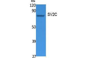 Western Blotting (WB) image for anti-Synaptic Vesicle Glycoprotein 2C (SV2C) (Internal Region) antibody (ABIN3187638) (SV2C Antikörper  (Internal Region))