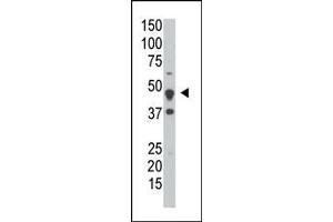 Image no. 1 for anti-Dual Specificity Phosphatase 6 (DUSP6) (Middle Region) antibody (ABIN360781) (DUSP6 Antikörper  (Middle Region))