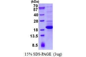 Tetratricopeptide Repeat Domain 32 (TTC32) protein (His tag)