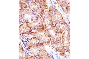 Immunohistochemical analysis of paraffin-embedded H. (MATN2 Antikörper  (AA 732-760))