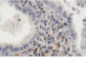 Immunoperoxidase of purified MaxPab antibody to LRP1 on formalin-fixed paraffin-embedded human endometrium. (LRP1 Antikörper  (AA 1-292))