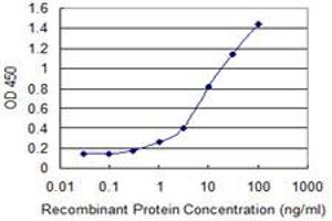 Detection limit for recombinant GST tagged ADNP is 0. (ADNP Antikörper  (AA 1018-1102))