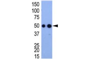 Western Blotting (WB) image for anti-HA-Tag antibody (ABIN2932102) (HA-Tag Antikörper)