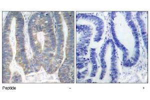 Image no. 1 for anti-Eukaryotic Translation Initiation Factor 2-alpha Kinase 2 (EIF2AK2) (Thr451) antibody (ABIN197554) (EIF2AK2 Antikörper  (Thr451))