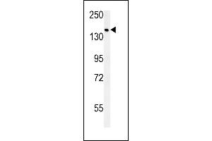 SD9 Antibody (C-term) (ABIN651896 and ABIN2840442) western blot analysis in MCF-7 cell line lysates (15 μg/lane). (SAMD9 Antikörper  (C-Term))