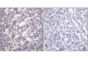 Immunohistochemistry analysis of paraffin-embedded human lymph node, using B-RAF (Phospho-Ser602) Antibody. (SNRPE Antikörper  (pSer602))