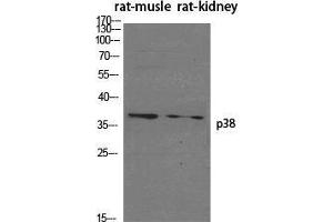 Western Blot (WB) analysis of specific cells using p38 Polyclonal Antibody. (MAPK14 Antikörper  (Ser272))