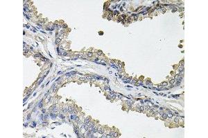 Immunohistochemistry of paraffin-embedded Human prostate using ACO1 Polyclonal Antibody at dilution of 1:100 (40x lens). (Aconitase 1 Antikörper)